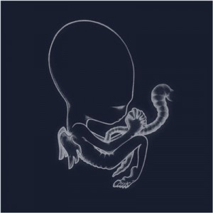 Sigur Rós - Ágætis Byrjun