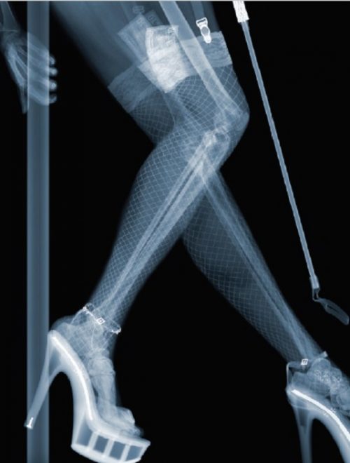 X-Ray Photography Art by Nick Veasey 014