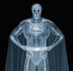X-Ray Photography Art by Nick Veasey – Superman