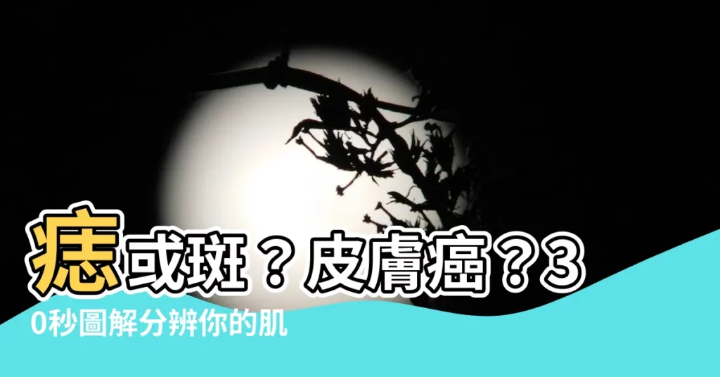 【痣 斑】痣或斑？皮膚癌？30秒圖解分辨你的肌膚問題！