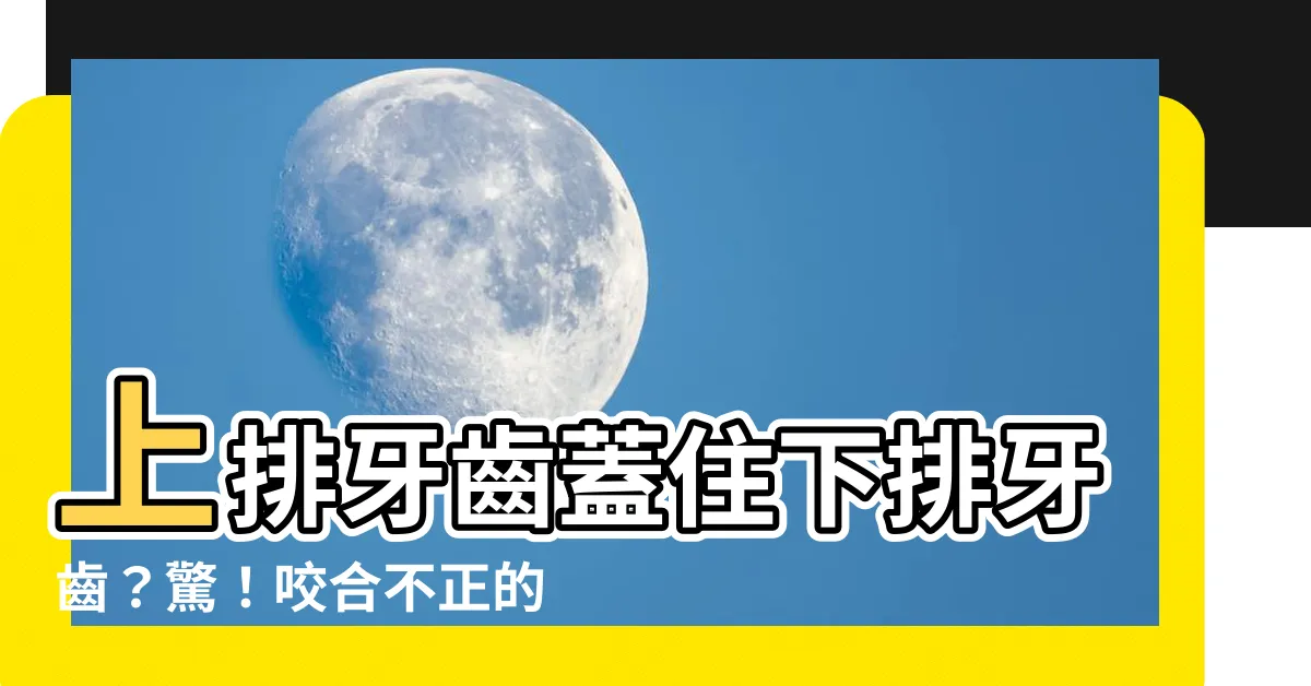 【上排牙齒蓋住下排牙齒】上排牙齒蓋住下排牙齒？驚！咬合不正的秘密全在這