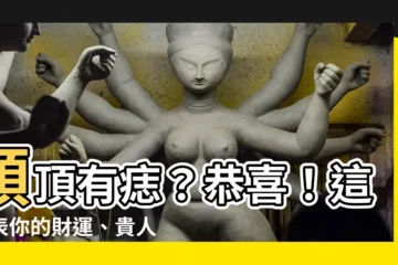 【頭頂 有痣】頭頂有痣？恭喜！這代表你的財運、貴人運超旺！