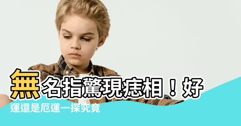 【無名指突然長痣】無名指驚現痣相！好運還是厄運一探究竟