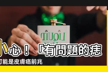 【有問題的痣】小心！「有問題的痣」可能是皮膚癌前兆：5大特徵教你分辨