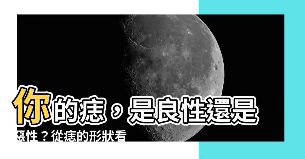 【痣的形狀】你的痣，是良性還是惡性？從痣的形狀看端倪！