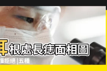 【耳根面相】耳根處長痣面相圖 |不懂拒絕 |五種容易遇到渣男的女人面相 |