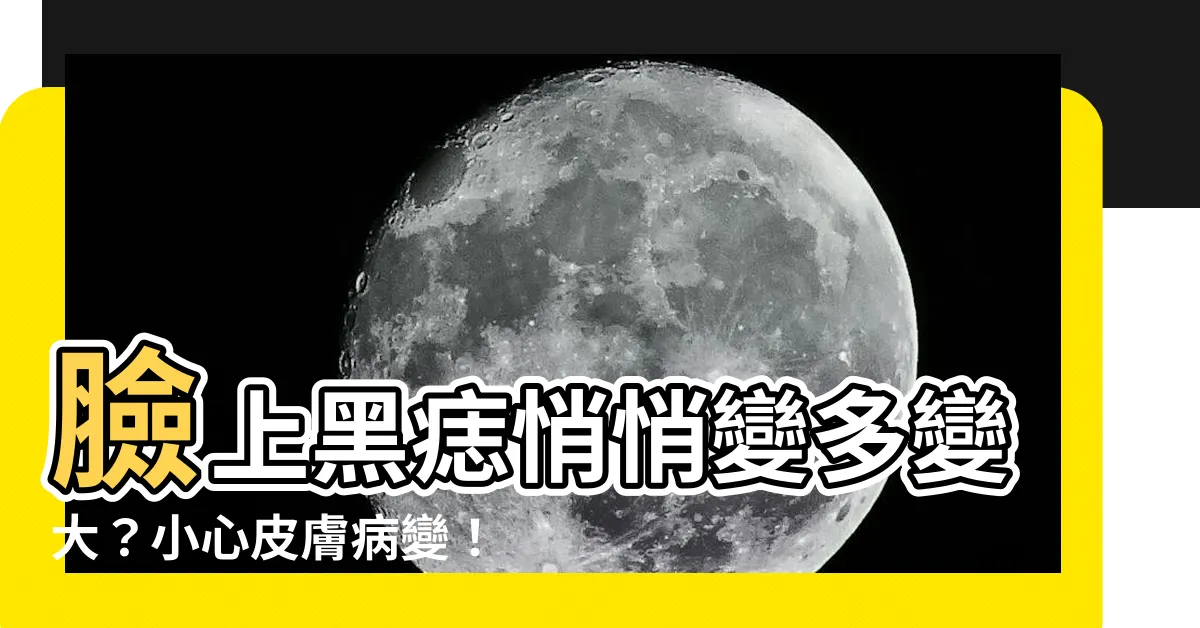 【長黑痣的原因】臉上黑痣悄悄變多變大？小心皮膚病變！