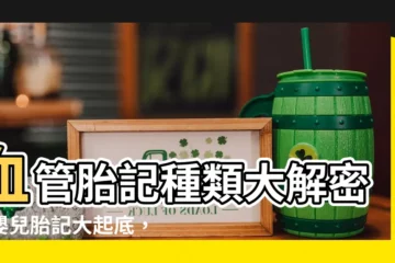 【血管胎記】血管胎記種類大解密！嬰兒胎記大起底，常見種類一次看！
