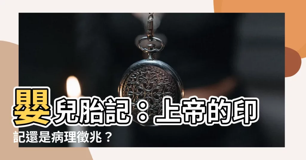 【嬰兒胎記】嬰兒胎記：上帝的印記還是病理徵兆？