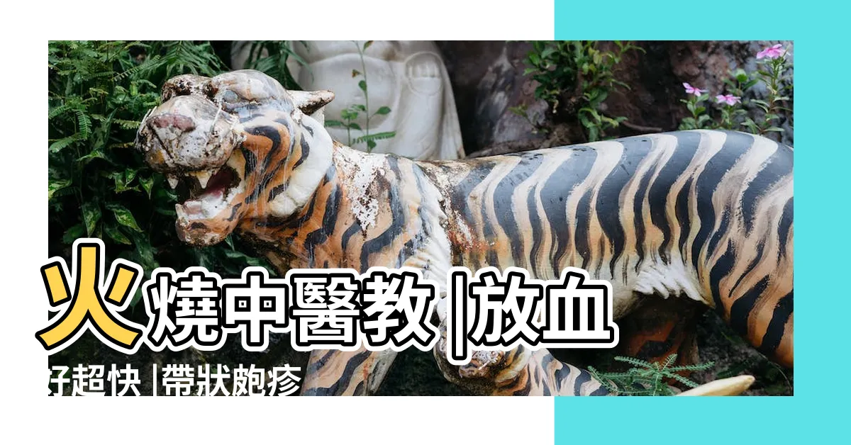 【龍眼穴】火燒中醫教 |放血好超快 |帶狀皰疹發作像刀割 |