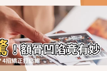 【額骨凹陷】驚！額骨凹陷竟有妙招？4招矯正打造飽滿額頭