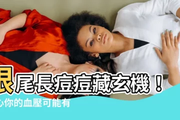 【眼尾長痘痘】眼尾長痘痘藏玄機！小心你的血壓可能有狀況