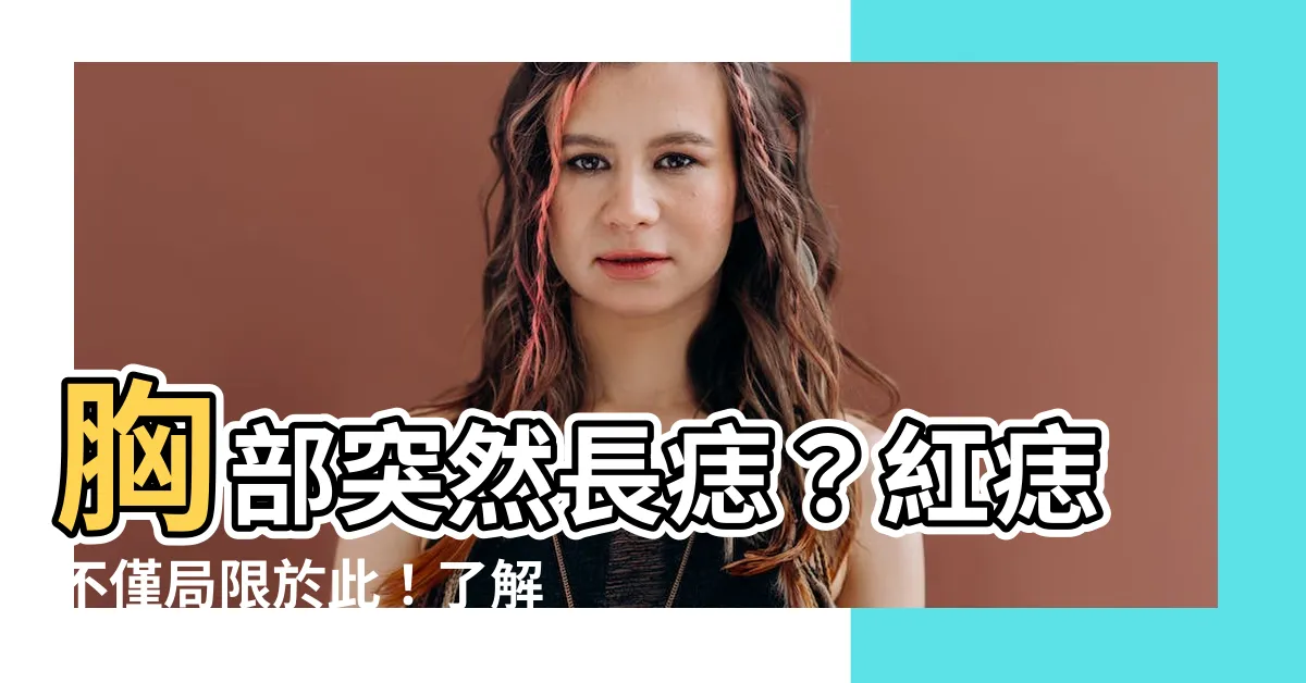 【胸部突然長痣】胸部突然長痣？紅痣不僅侷限於此！瞭解5點辨別好壞的原則