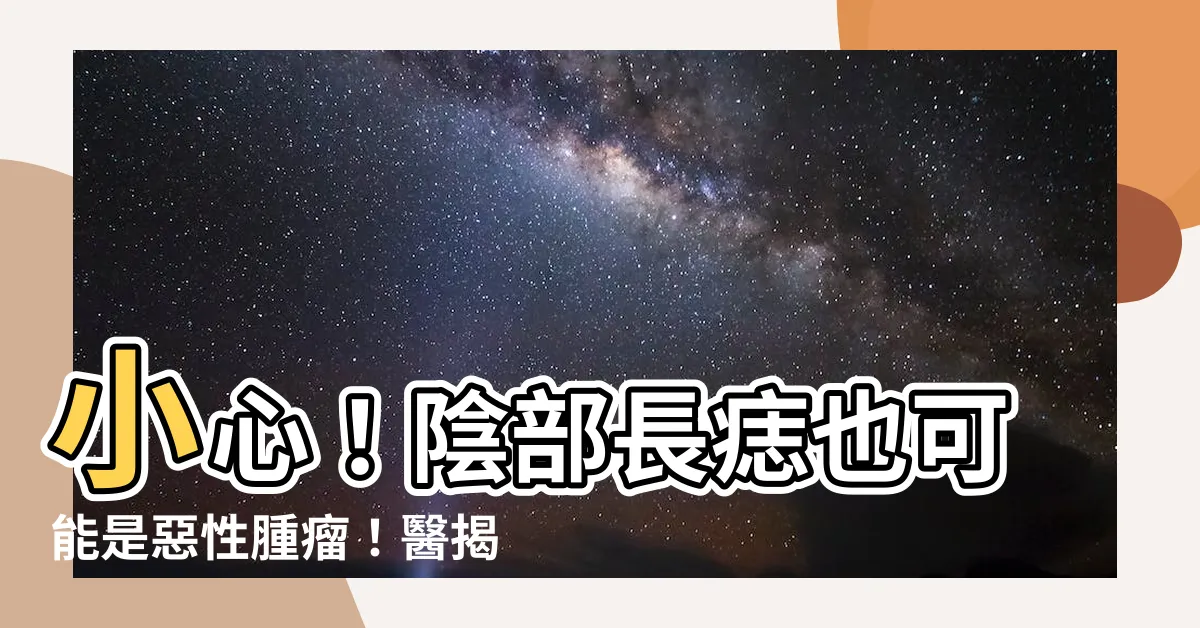 【陰部 痣】小心！陰部長痣也可能是惡性腫瘤！醫揭5大高危險羣