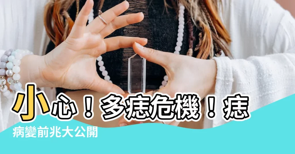 【多痣】小心！多痣危機！痣病變前兆大公開