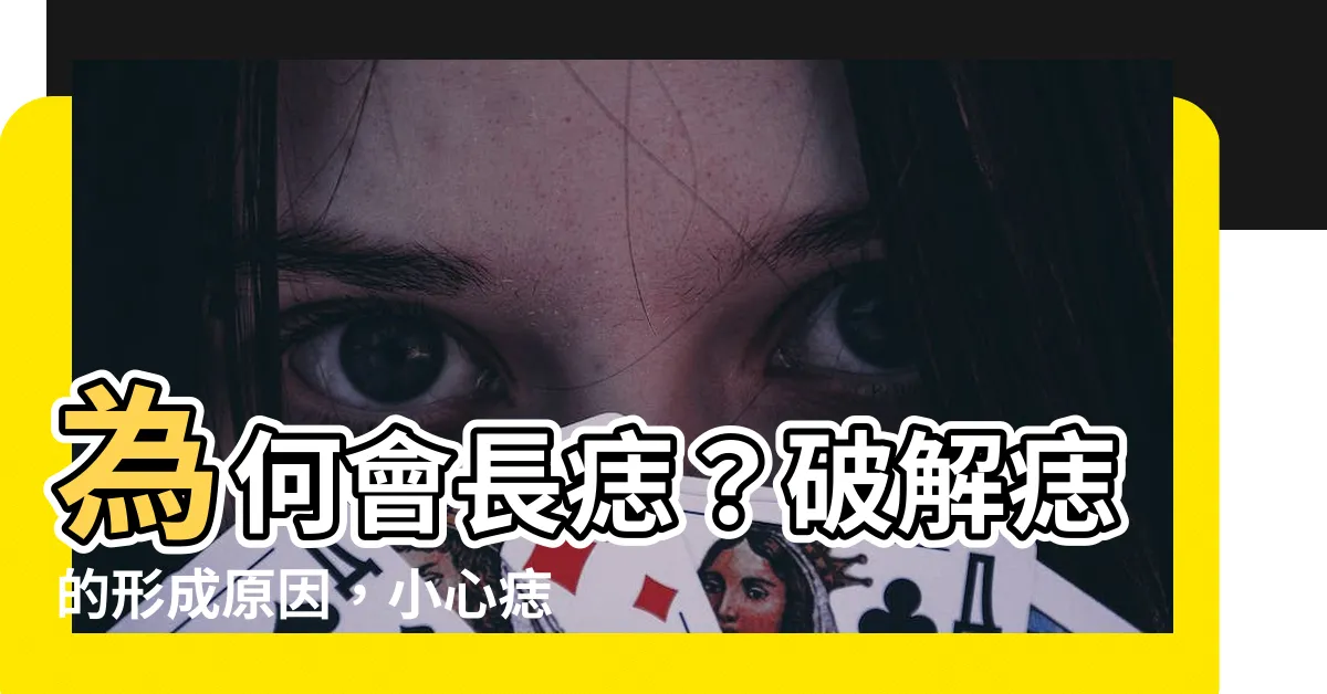 【為何會長痣】為何會長痣？破解痣的形成原因，小心痣癌變的徵兆！