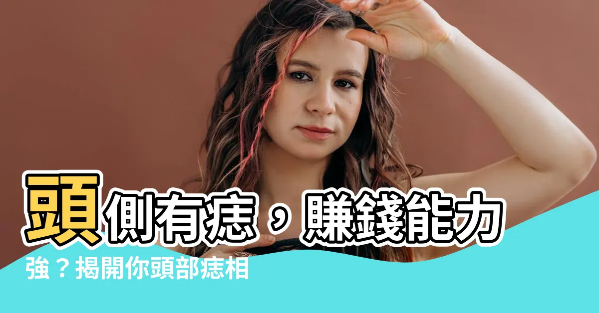 【頭側有痣】頭側有痣，賺錢能力強？揭開你頭部痣相的秘密