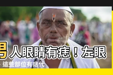 【眼睛有痣男】男人眼睛有痣！左眼尾、這些部位有痣代表什麼？