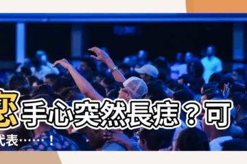 【左手掌突然長痣】您手心突然長痣？可能代表……！