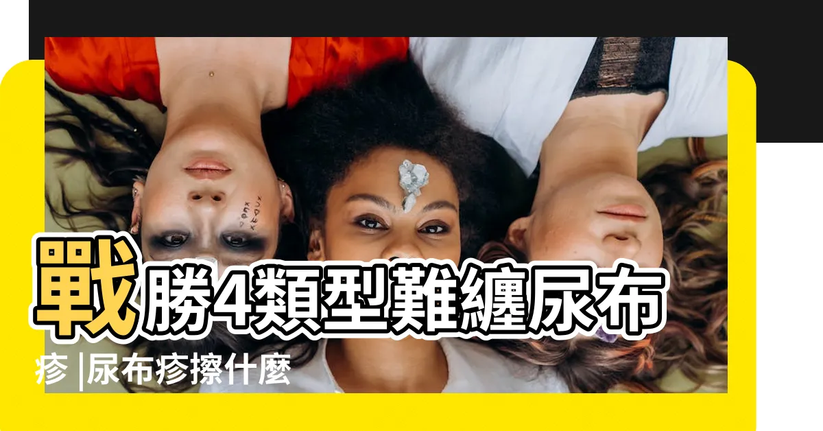 【嬰兒屁股】戰勝4類型難纏尿布疹 |尿布疹擦什麼 |尿布疹怎麼辦 |