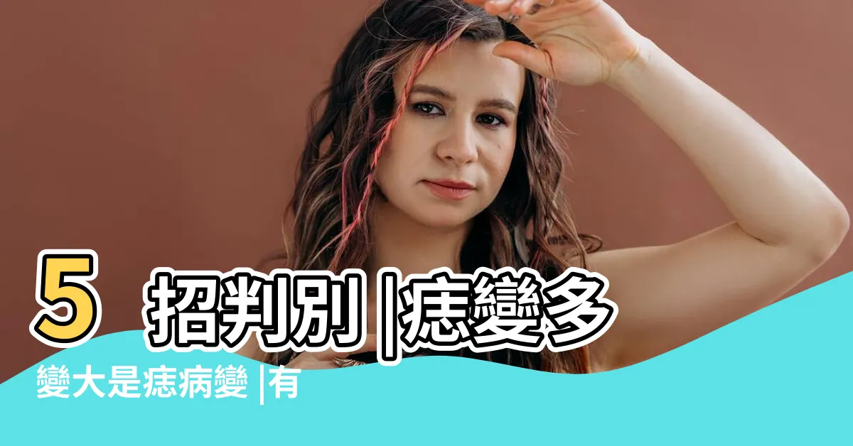 【多痣體質】5招判別 |痣變多變大是痣病變 |有5種痣外觀最危險 |