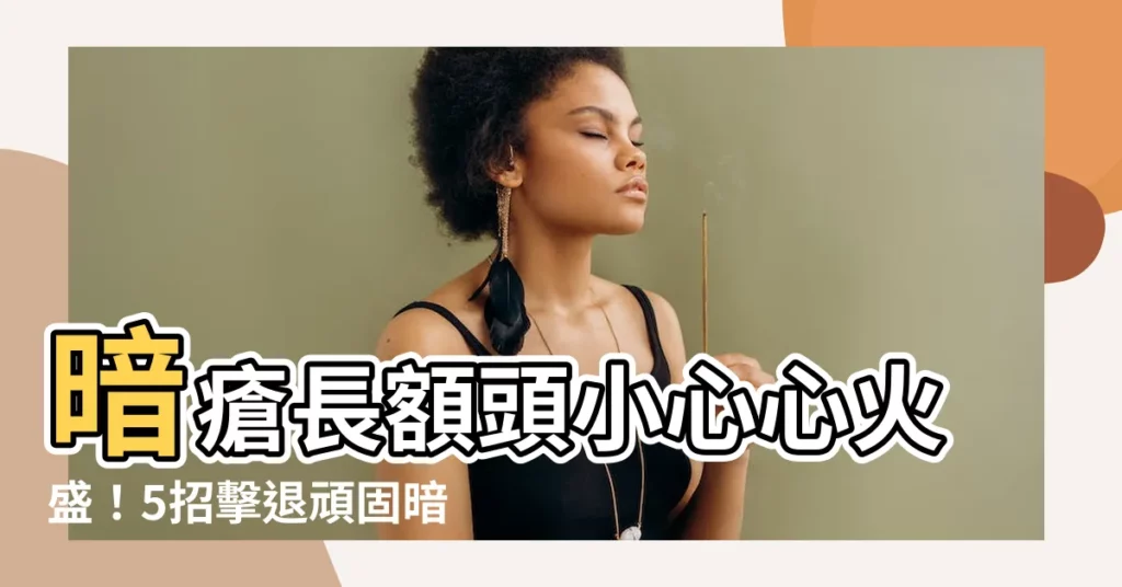 【暗瘡 額頭】暗瘡長額頭小心心火盛！5招擊退頑固暗瘡，告別額頭危機