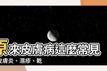 【皮膚病】原來皮膚病這麼常見！皮膚炎、濕疹、乾癬一次搞懂！
