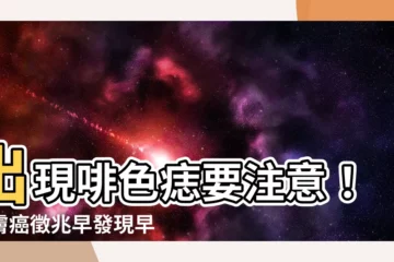 【啡色痣】出現啡色痣要注意！皮膚癌徵兆早發現早治療