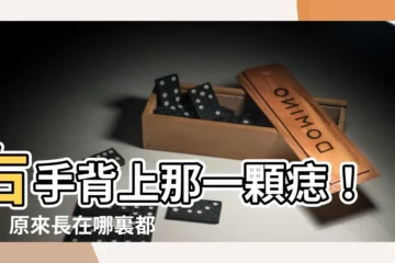 【右手背突然長痣】右手背上那一顆痣！驚！原來長在哪裏都是有意義的