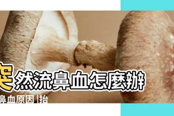 【鼻子突然出血不止】突然流鼻血怎麼辦 |流鼻血原因 |抬頭就能止血 |