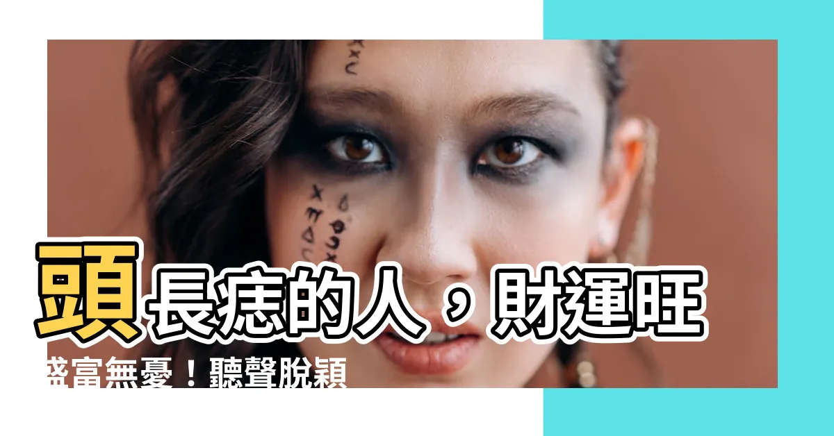 【頭長痣】頭長痣的人，財運旺盛富無憂！聽聲脱穎而出成就鉅富之路
