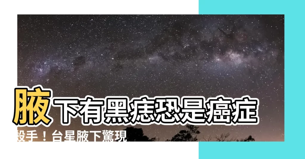 【腋下有黑痣】腋下有黑痣恐是癌症殺手！台星腋下驚現黑痣兩異狀需注意
