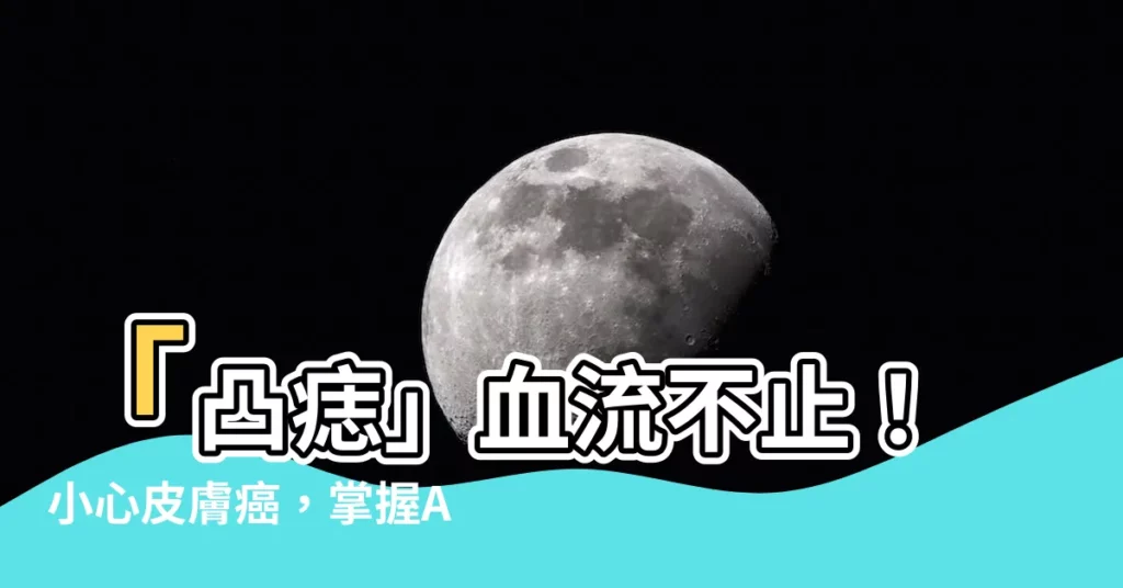 【凸痣流血】「凸痣」血流不止！小心皮膚癌，掌握ABCDE前兆
