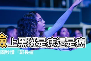 【斑 痣】臉上黑斑是痣還是癌？3圖秒懂「斑長這樣是癌症！」