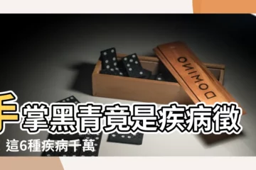 【手掌黑青】手掌黑青竟是疾病徵兆！這6種疾病千萬別輕忽！