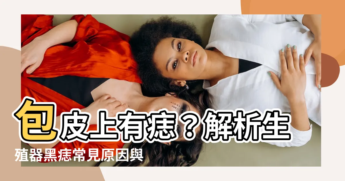 【包皮上有痣】包皮上有痣？解析生殖器黑痣常見原因與處理之道