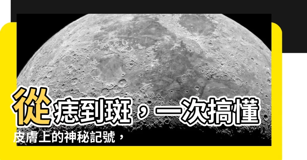 【痣 斑】從痣到斑，一次搞懂皮膚上的神秘記號，輕鬆除痣去斑！