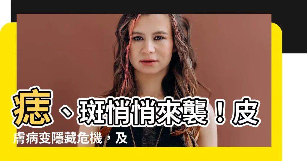 【痣 斑】痣、斑悄悄來襲！皮膚病變隱藏危機，及早揪出防癌變