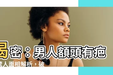 【男人額頭有疤】揭密：男人額頭有疤的驚人面相解析，破除倒楣傳言！