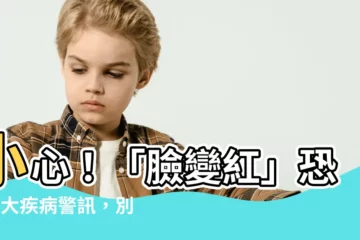 【臉變紅】小心！「臉變紅」恐是6大疾病警訊，別忽視了這些身體異常
