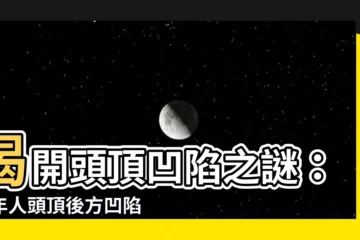 【頭頂後方凹陷】揭開頭頂凹陷之謎：成年人頭頂後方凹陷成因大追蹤