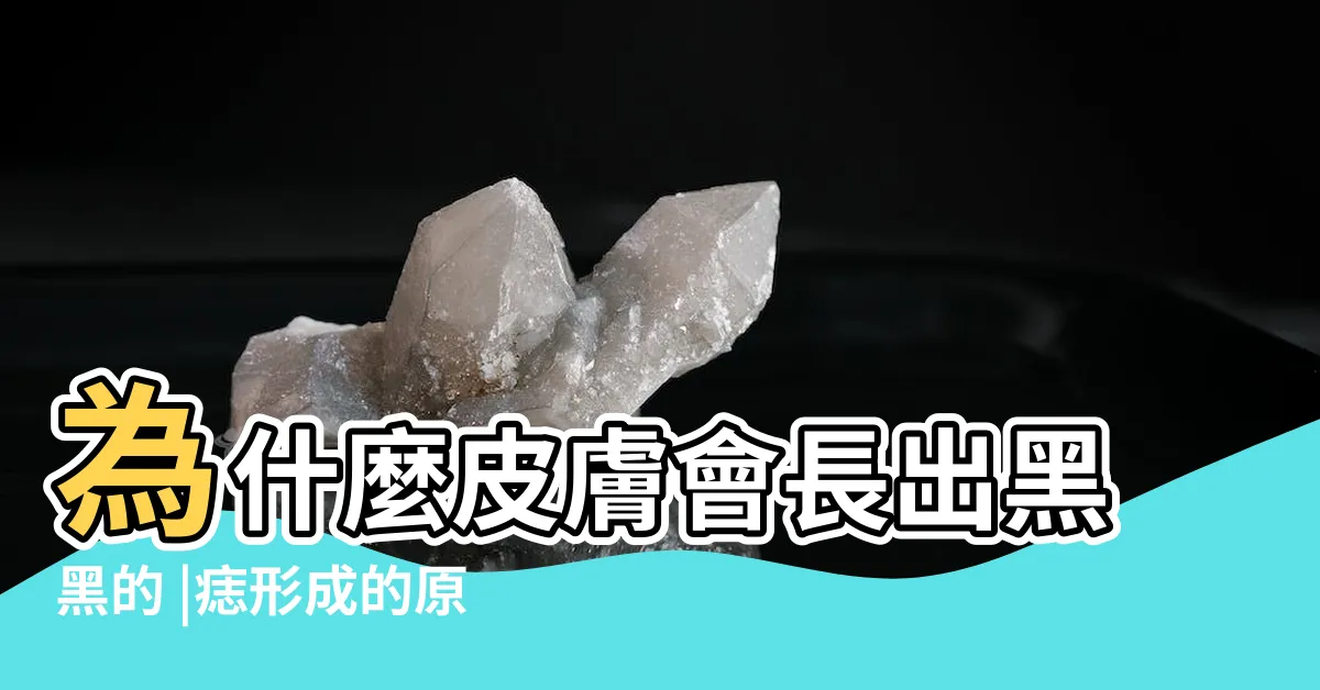 【痣的生成】為什麼皮膚會長出黑黑的 |痣形成的原因 |痣變多變大是痣病變 |