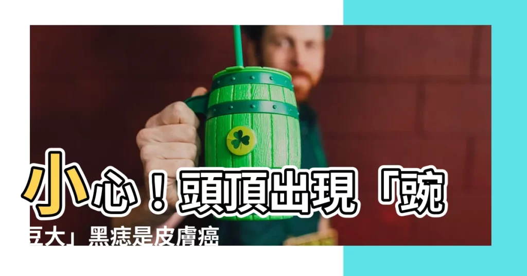 【頭頂有黑痣】小心！頭頂出現「豌豆大」黑痣是皮膚癌「大魔王」的徵兆！