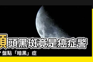 【額頭黑斑】額頭黑斑竟是癌症警訊？盤點「暗黑」症狀藏危機