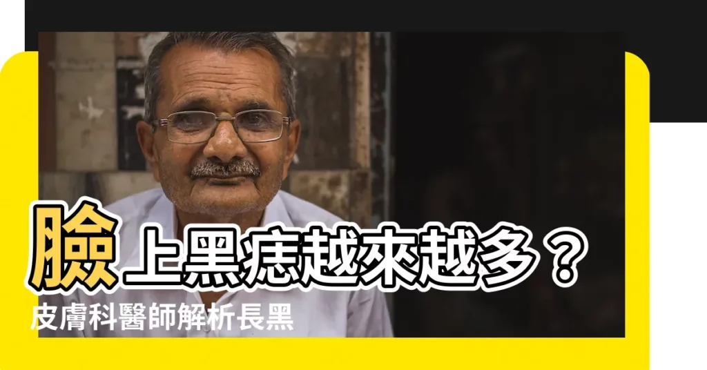 【長黑痣的原因】臉上黑痣越來越多？皮膚科醫師解析長黑痣的原因、治療方式