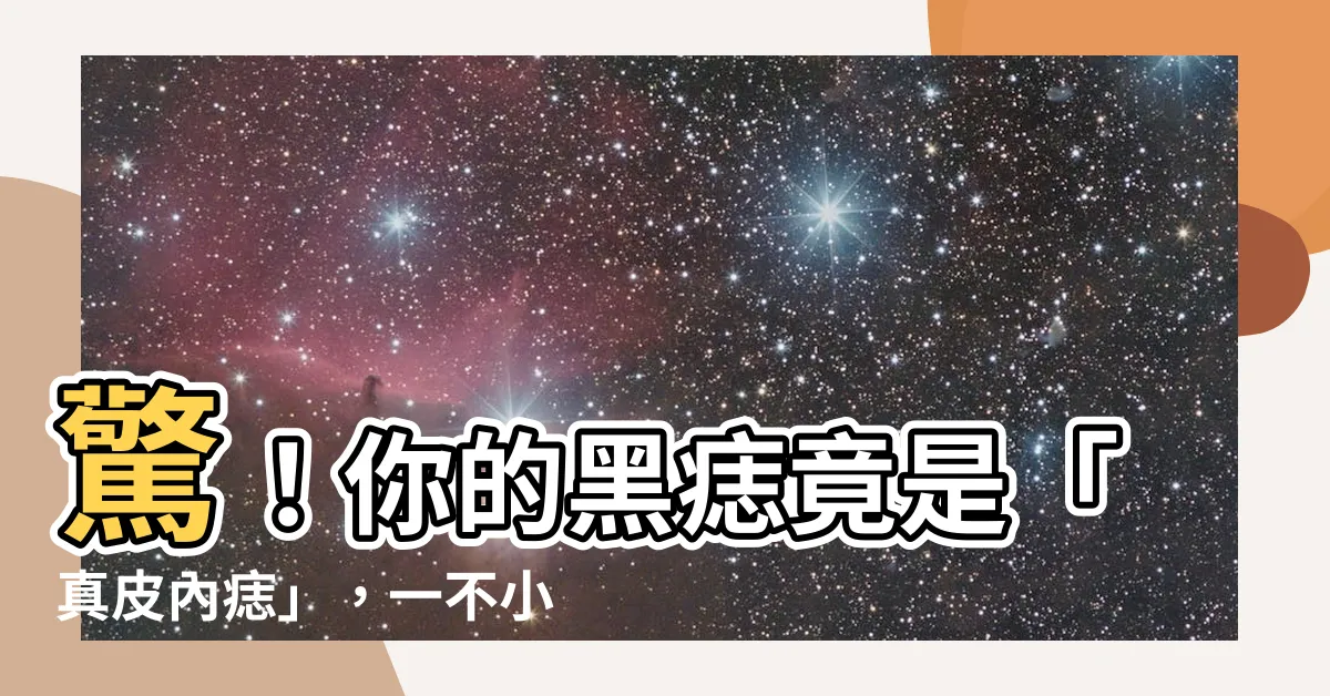 【真皮內痣】驚！你的黑痣竟是「真皮內痣」，一不小心恐癌變！