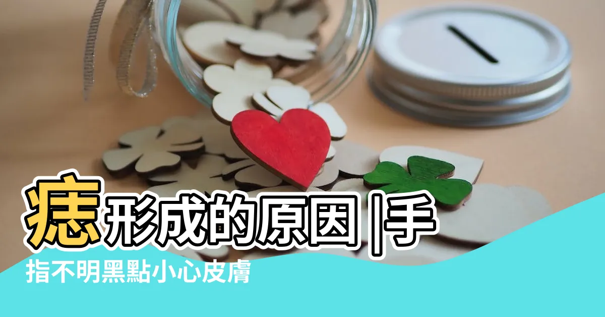 【手指突然長痣】痣形成的原因 |手指不明黑點小心皮膚癌 |醫指５徵兆惡性高盡早檢查 |