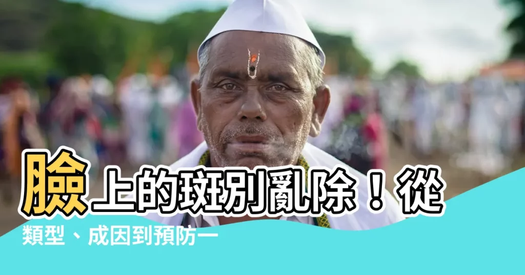 【臉上的斑】臉上的斑別亂除！從類型、成因到預防一次搞懂