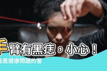 【手臂有黑痣】手臂有黑痣，小心！可能是健康問題的警訊！
