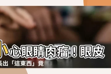 【眼睛肉瘤】小心眼睛肉瘤！眼皮內長出「這東西」竟是癌症徵兆